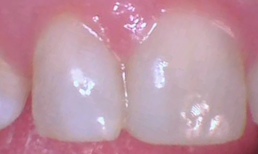 cosmetic dentistry durham nc