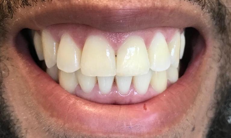 cosmetic dentistry | morrisville nc | the smile shop 