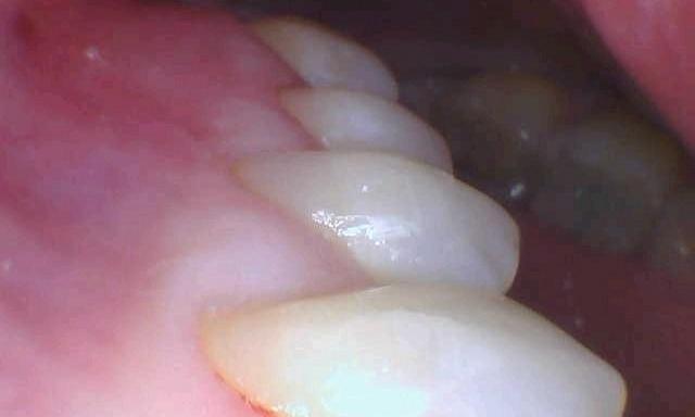 cosmetic dentistry | morrisville nc | the smile shop
