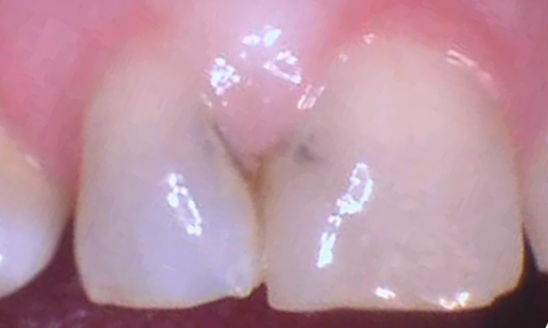 cosmetic restorations durham nc