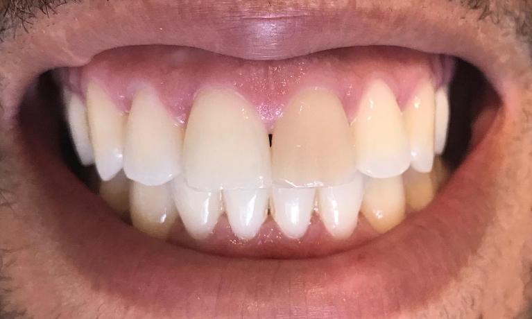 cosmetic dentistry | morrisville nc | the smile shop