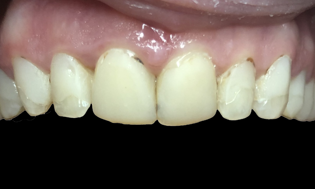 cosmetic dentist durham nc