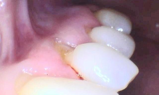 cosmetic dentistry | morrisville nc | the smile shop