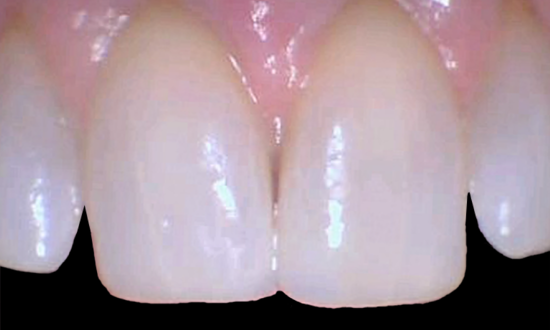 cosmetic dentist durham nc